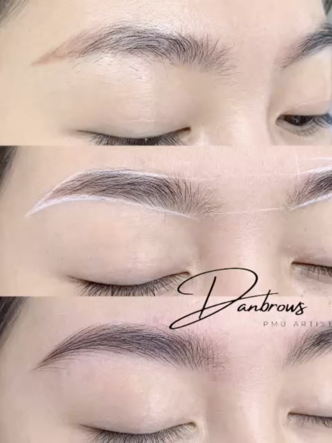 Signature Transformation - Before and After Brow Restoration